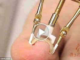 3 Ways to Prevent of Ingrown Toenails