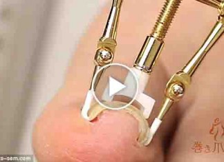 3 Ways to Prevent of Ingrown Toenails